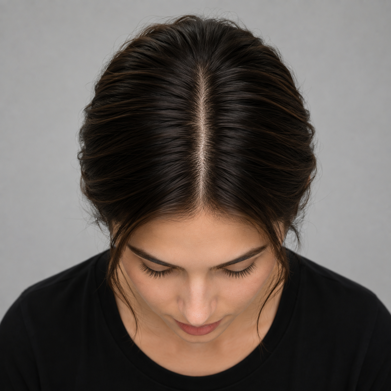 Hair scan Top / Crown